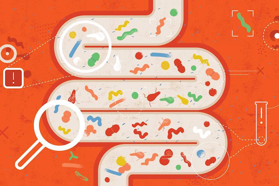 The Link Between Your Gut and the Early Stages of RA