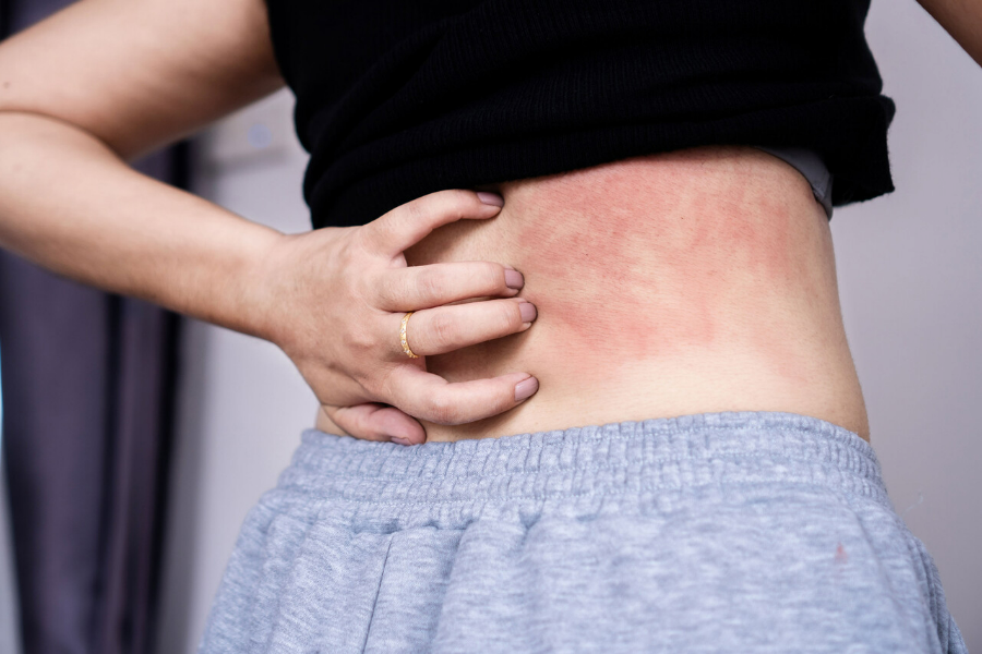 Behind Your Urge to Scratch